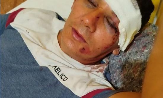 "Mi papá quedó muy traumado por lo que le hicieron esos policías"